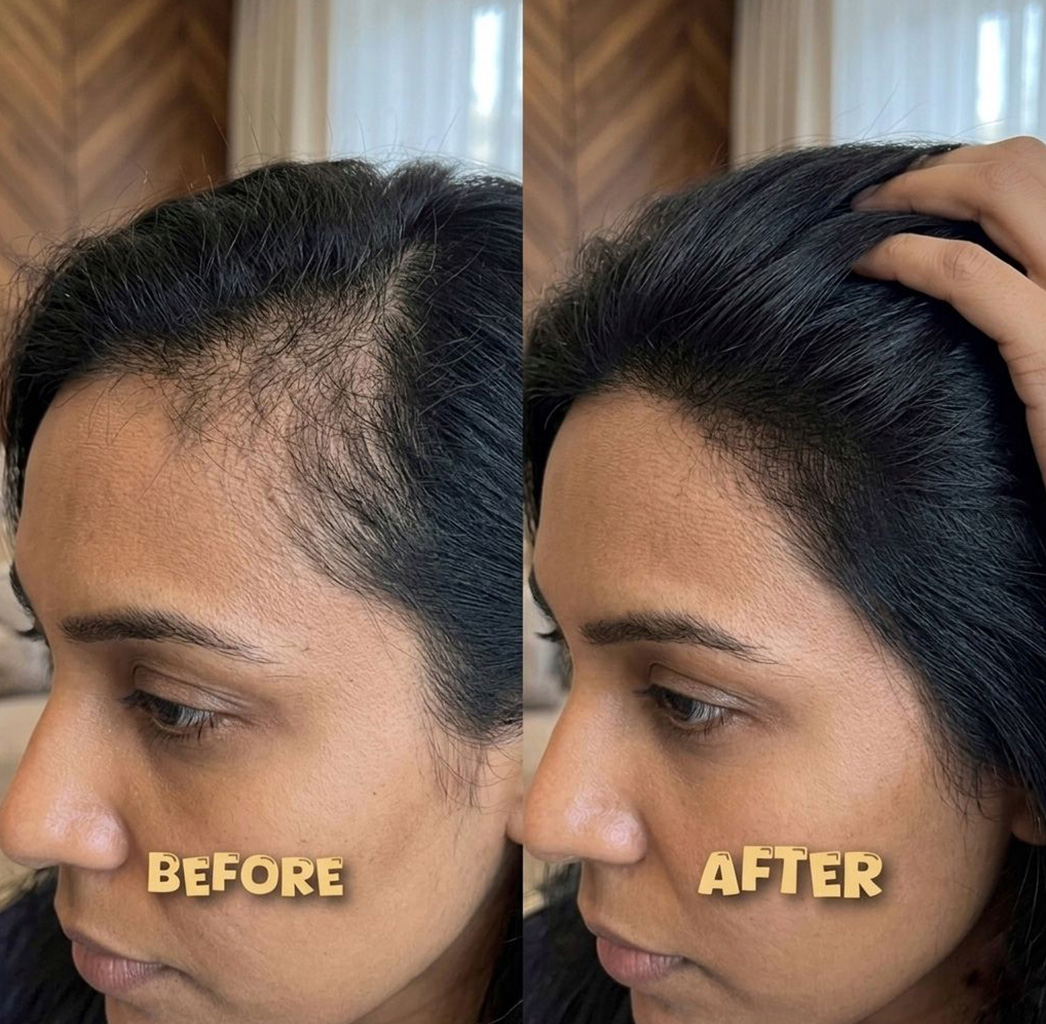 Hair result before and after thumbnail