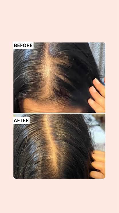 Hair result before and after thumbnail